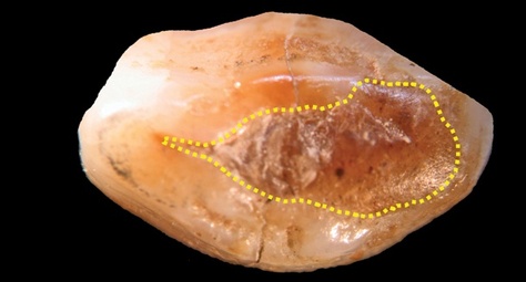 6,500 year old human lower jaw