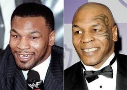 Mike Tyson