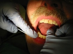 dentist flossing teeth