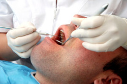 Man getting work done on his teeth by a dentist